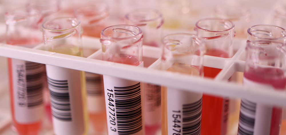 Bild på biobanksprov