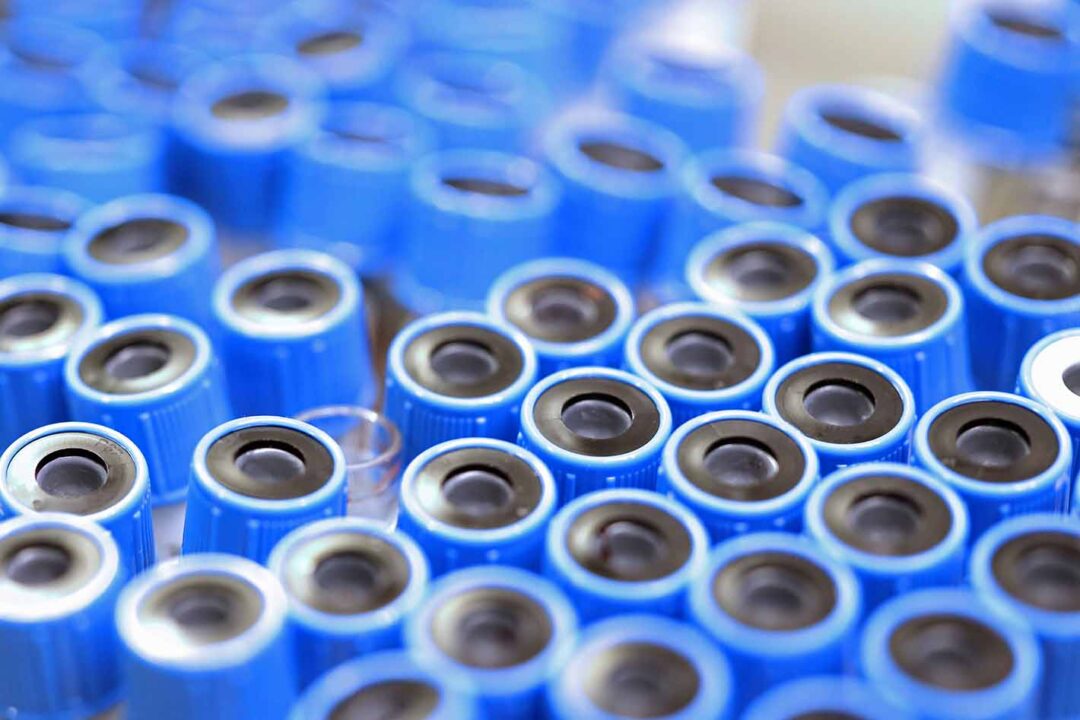 Bild som visar en stor mängd biobanksprov med blå korkar.