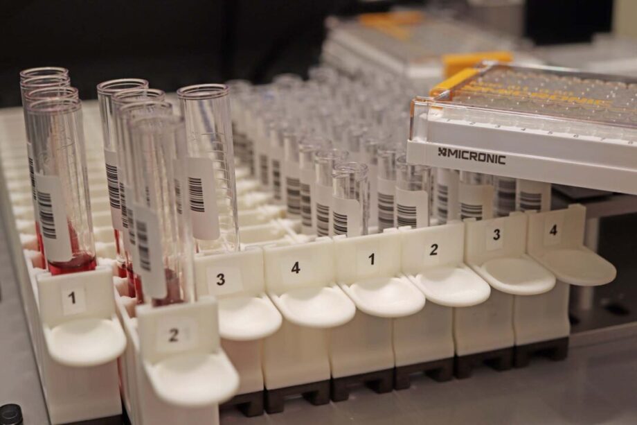 Bild som visar en samling av prov.