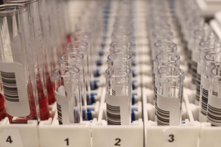 Bild som visar vätskeprov i flera rader.