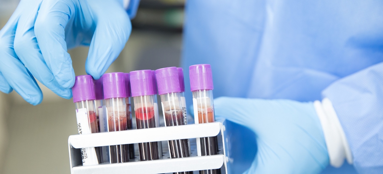 En person med vårdklädsel vidrör ett av flera provrör med blod som att det ska lyftas upp.