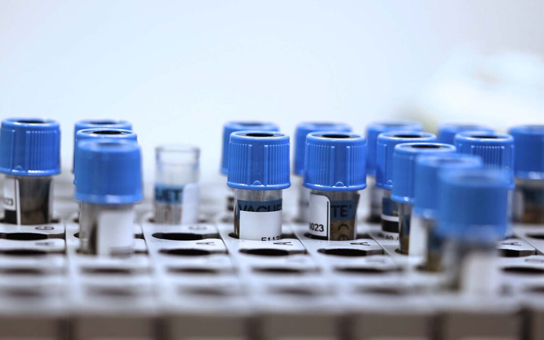 Provrör med blå korkar i ett ställ.