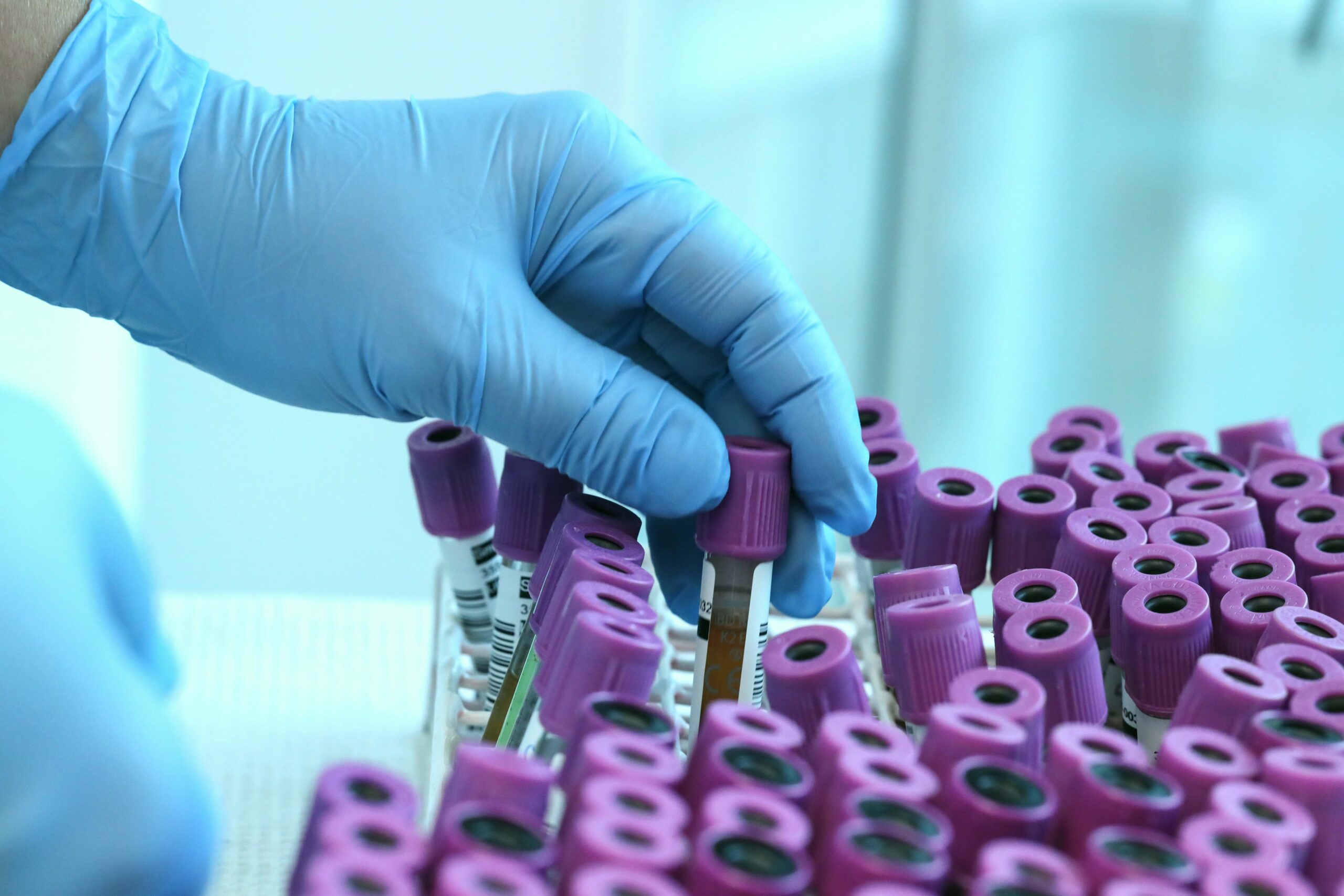 Människohand som plockar prov.