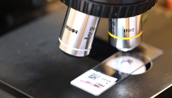 Bild på ett mikroskop över vävnadsprov.