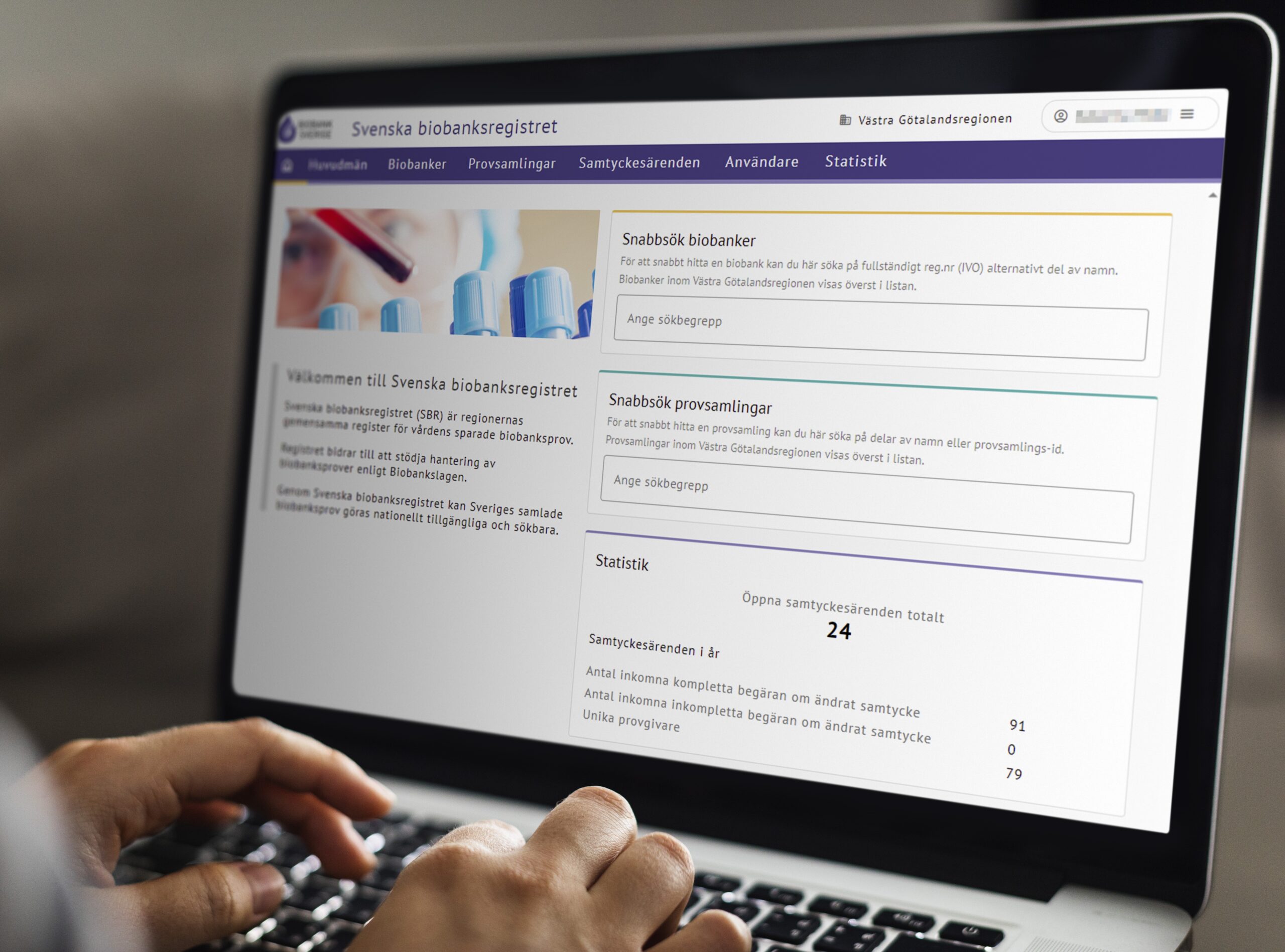 Bild som visar ett par händer och en bärbardator där man kan urskilja startsidan för SBR (Svenska Biobanksregistret).